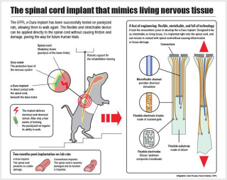 Illustration for article titled A Cybernetic Implant That Allows Paralyzed Rats To Walk Again